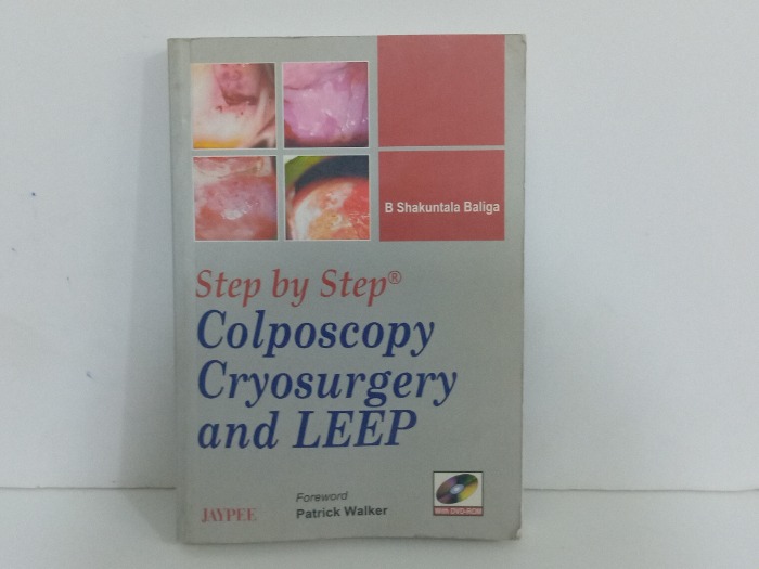 Step by Step Colposcopy Cryosurger and LEEP
