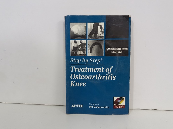 Treatment of osteoarthritis knee